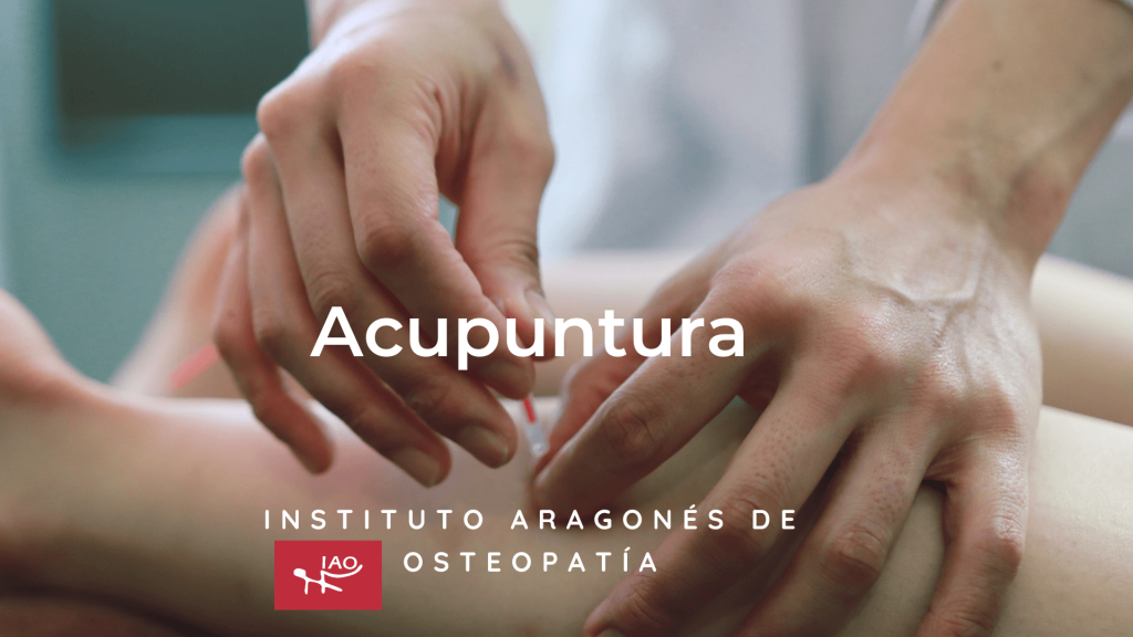 Acupuntura China Profesional