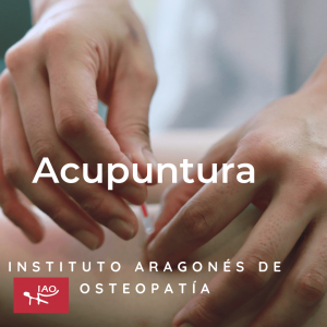 Acupuntura China Profesional