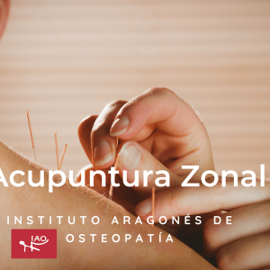 Acupuntura Zonal