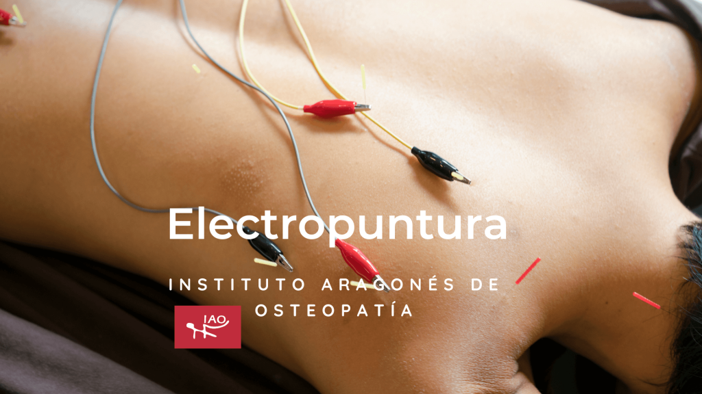 Electroacupuntura