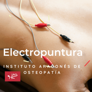 Electroacupuntura